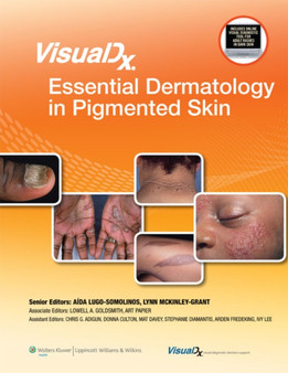 VisualDx: Essential Dermatology in Pigmented Skin by Lowell A. MD MPH Goldsmith - Hardback