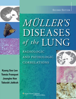 Muller's Diseases of the Lung : Radiologic and Pathologic Correlations by Kyung Soo Lee - Hardback