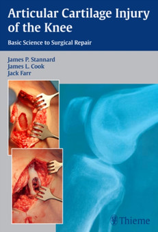 Articular Cartilage Injury of the Knee: Basic Science to Surgical Repair by James P. Stannard - Hardback
