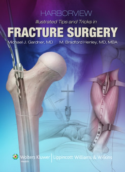 Harborview Illustrated Tips and Tricks in Fracture Surgery by Michael J. Gardner - Hardback
