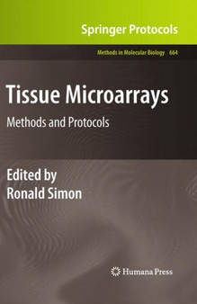 Tissue Microarrays : Methods and Protocols : 664 by Ronald Simon - Hardback