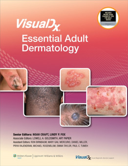 VisualDx: Essential Adult Dermatology by Lowell A. MD MPH Goldsmith - Hardback