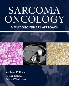 Sarcoma Oncology by Raphael Pollock - Hardback