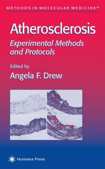 Atherosclerosis : Experimental Methods and Protocols : 52 by Angela F. Drew - Paperback