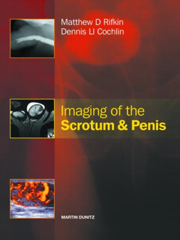 Imaging of the Scrotum & Penis by Matthew Rifkin - Hardback