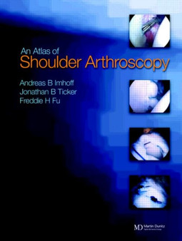 Atlas of Shoulder Arthroscopy by Andreas B. Imhoff - Hardback