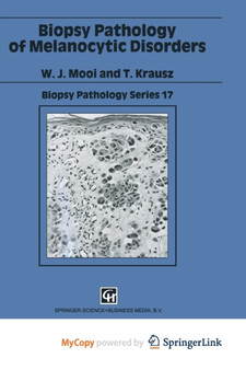 Biopsy Pathology of Melanocytic Disorders by Mooi W. J. Mooi - Paperback