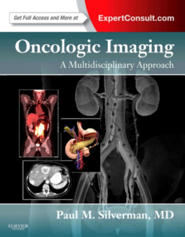 Oncologic Imaging: A Multidisciplinary Approach : Expert Consult - Online and Print by Paul M. Silverman - Hardback