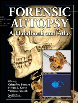 Forensic Autopsy : A Handbook and Atlas by Cristoforo Pomara - Hardback