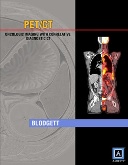 Specialty Imaging: PET/CT : Oncologic Imaging with Correlative Diagnostic CT by Todd M. Blodgett - Hardback