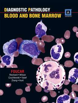 Diagnostic Pathology: Blood and Bone Marrow by Kathy Foucar - Hardback