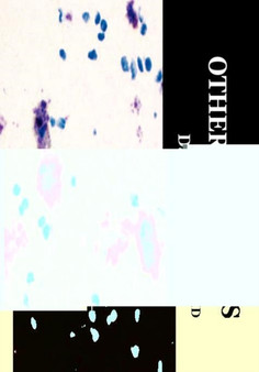Other Dementias by David Geldmacher - Hardback