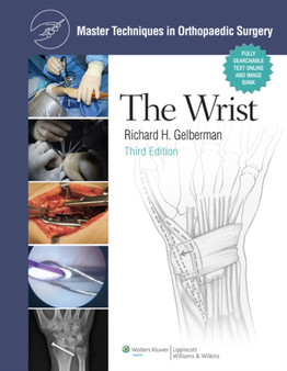 Master Techniques in Orthopaedic Surgery: The Wrist by Richard H. Gelberman - Hardback