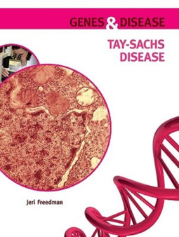 Tay-Sachs Disease by Jeri Freedman - Hardback