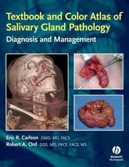 Textbook and Color Atlas of Salivary Gland Pathology : Diagnosis and Management by Eric R. Carlson - Hardback