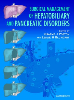 Surgical Management of Hepatobiliary and Pancreatic Disorders by Graeme J. Poston - Hardback