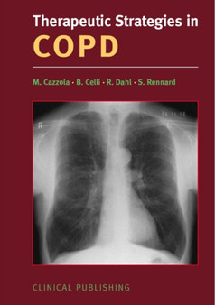 Therapeutic Strategies in COPD by M. Cazzola - Hardback