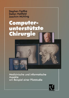 Computerunterstutzte Chirurgie : Medizinische und informatische Aspekte am Beispiel einer Pilotstudie by Stephen Fedtke - Paperback