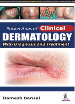 Pocket Atlas of Clinical Dermatology by Ramesh Bansal - Paperback
