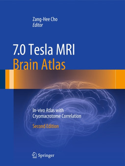 7.0 Tesla MRI Brain Atlas : In-vivo Atlas with Cryomacrotome Correlation by Zang-Hee Cho - Hardback