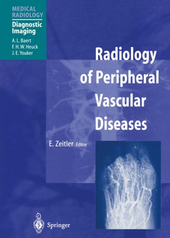 Radiology of Peripheral Vascular Diseases by E. Zeitler - Paperback