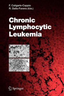 Chronic Lymphocytic Leukemia : 294 by Federico Caligaris-Cappio - Paperback