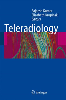 Teleradiology by Sajeesh Kumar - Paperback