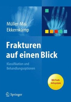 Frakturen auf einen Blick by Christian Muller-Mai - Paperback
