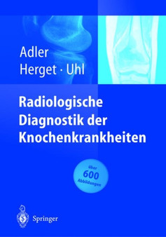 Radiologische Diagnostik Der Knochenkrankheiten by C -P Adler - Hardback