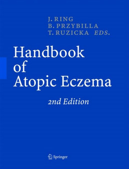 Handbook of Atopic Eczema by Johannes Ring - Hardback