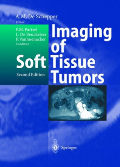 Imaging of Soft Tissue Tumors by A.M.A.de Schepper - Hardback