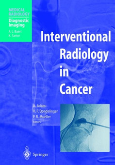 Interventional Radiology in Cancer by Andreas Adam - Hardback