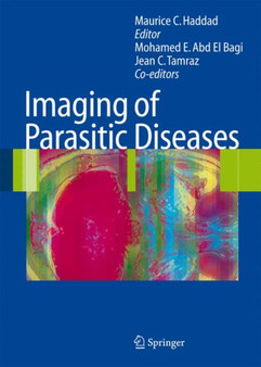 Imaging of Parasitic Diseases by Mohamed E. Abd El Bagi - Hardback