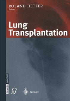 Lung Transplantation by R. Hetzer - Paperback