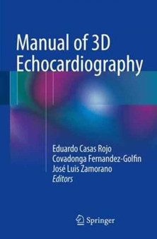 Manual of 3D Echocardiography by Eduardo Casas Rojo - Paperback