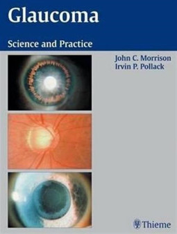 Glaucoma : Science and Practice by John C. Morrison - Hardback