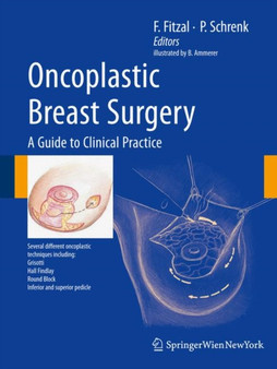 Oncoplastic Breast Surgery by Bernard Ammerer - Hardback