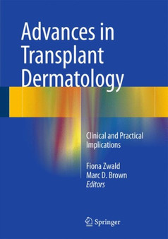 Advances in Transplant Dermatology : Clinical and Practical Implications by Fiona Zwald - Hardback