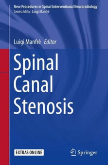 Spinal Canal Stenosis by Luigi Manfre - Paperback