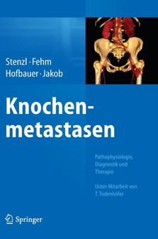 Knochenmetastasen : Pathophysiologie, Diagnostik und Therapie - Unter Mitarbeit von T. Todenhoefer by Arnulf Stenzl - Hardback