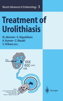 Treatment of Urolithiasis : 3 by M. Akimoto - Hardback
