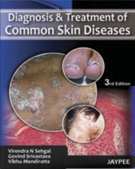 Diagnosis and Treatment of Common Skin Diseases by Virendra N. Sehgal - Hardback