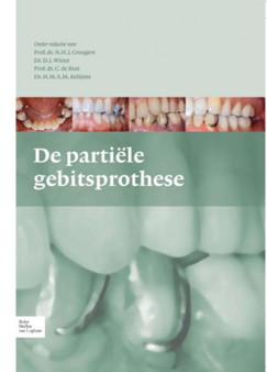 de Partiele Gebitsprothese : Uitgangspunten Bij de Diagnostiek En Behandeling Van Het Gemutileerde Gebit by N H J Creugers - Hardback