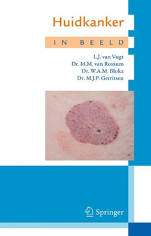 Huidkanker in beeld by M.J.P. Gerritsen - Paperback