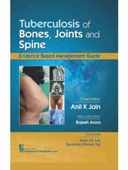 Tubercolosis of Bones, Joints and Spine by A.K. Jain - Paperback