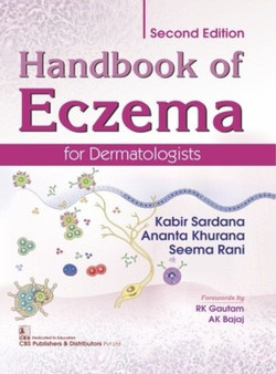 Handbook of Eczema for Dermatologists by K. Sardana - Hardback