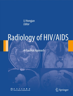 Radiology of HIV/AIDS : A Practical Approach by Hongjun Li - Hardback