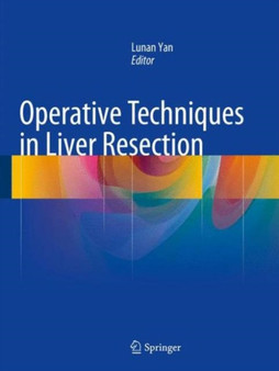 Operative Techniques in Liver Resection by Lunan Yan - Hardback