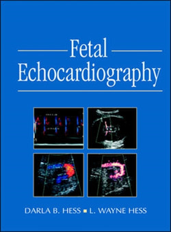 Fetal Echocardiography by Darla Hess - Hardback
