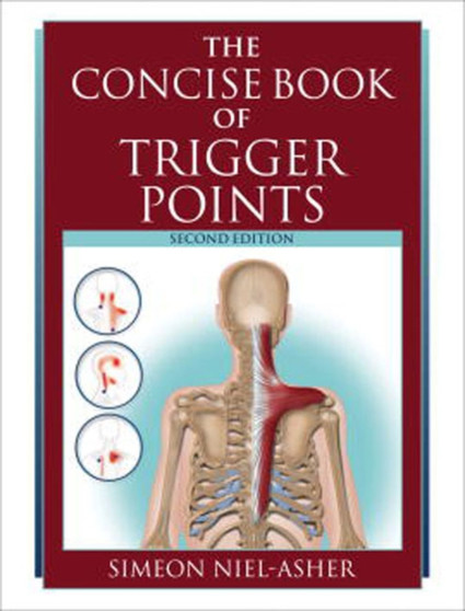 The Concise Book of Trigger Points by Simeon Niel-Asher - Paperback